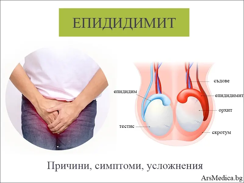 Епидидимит – причини, симптоми, усложнения