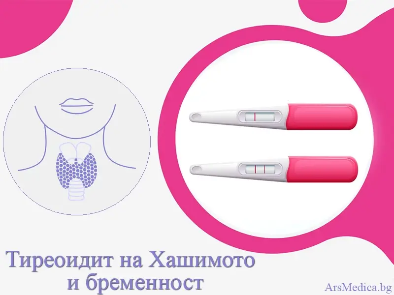 hashimoto-bremennost женския фертилитет