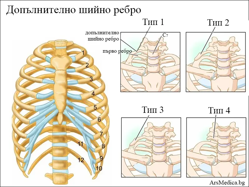 shiyno-rebro допълнително шийно ребро