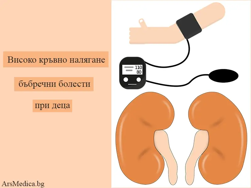 Високо кръвно налягане и бъбречни болести при деца