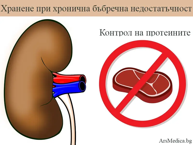Хранене при хронична бъбречна недостатъчност (ХБН)