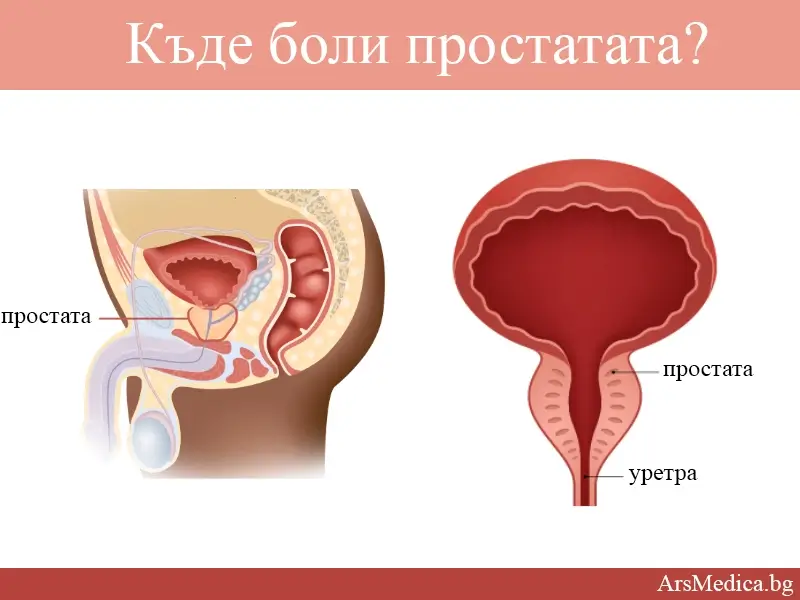 Къде боли простатата?