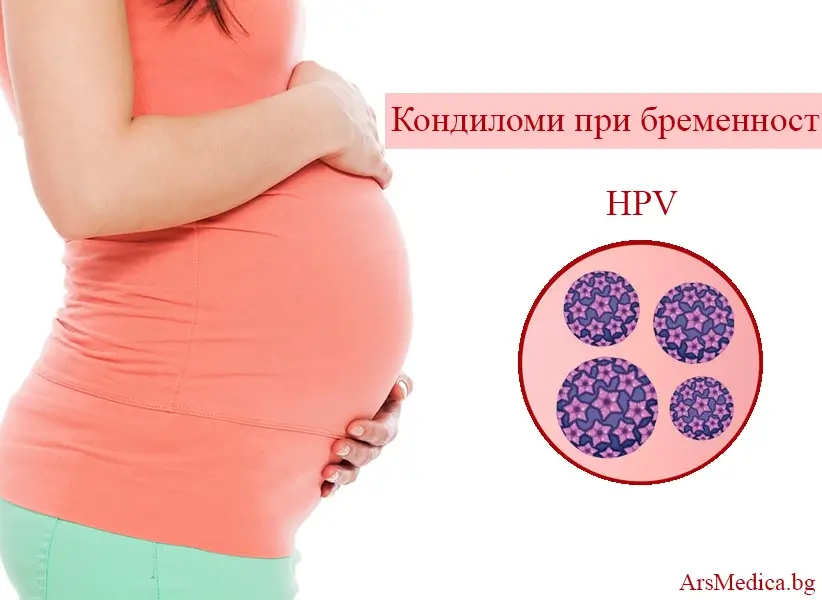 Кондиломи при бременност – рискове за майката и бебето