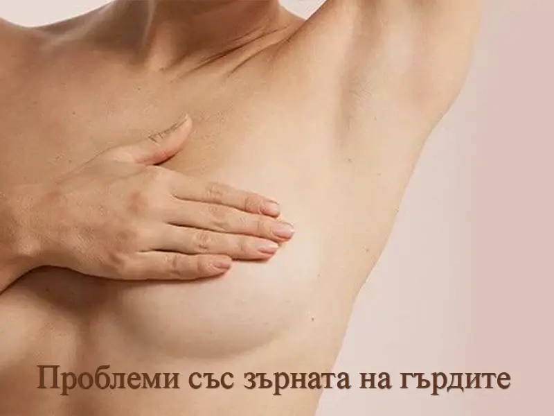 Проблеми със зърната на гърдите при жени